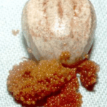 Let hier goed op als je mysterieuze eieren in de tuin vindt! Dit kan je een plaag besparen