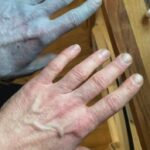 Hij wordt knalblauw wakker… wat de arts daarna ontdekt is echt bizar!