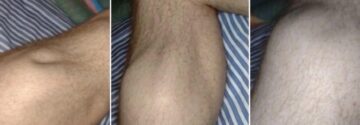 Word jij ook wakker van pijnlijke beenkrampen? Dit zijn de oorzaken én wat je direct kunt doen